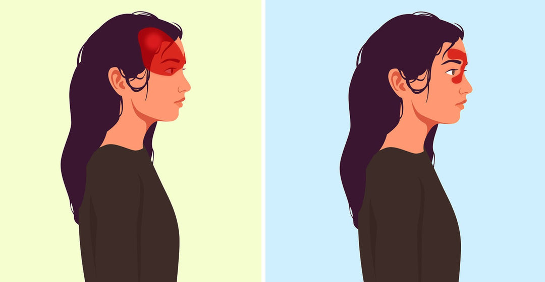 7 things that might be triggering your headaches and how to prevent them