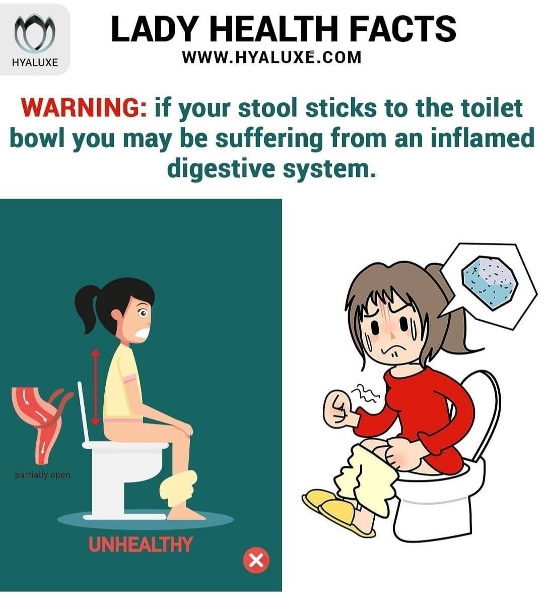 Why Does My Poop Stick To The Toilet? Causes & Solutions