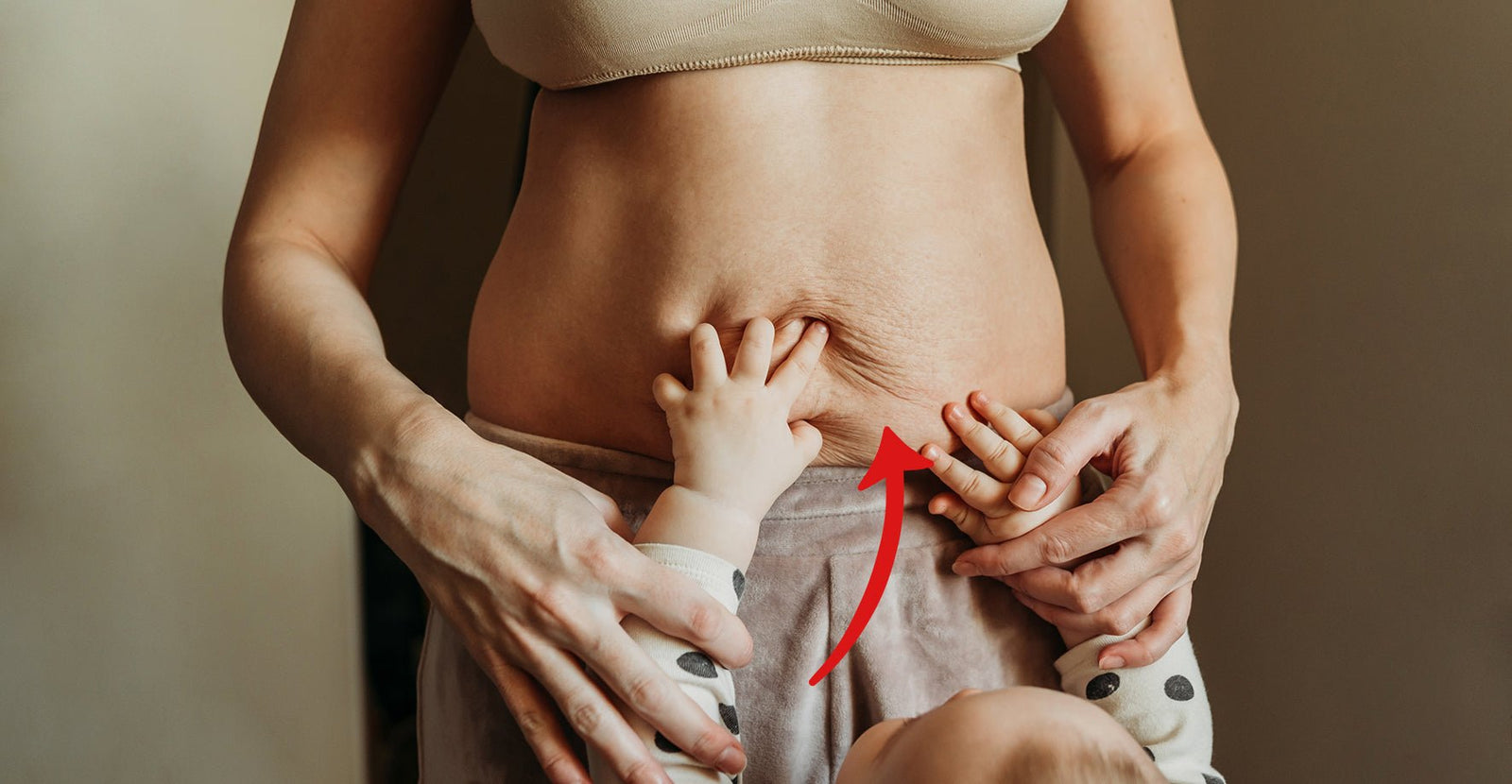 How to reduce scars and stretchmarks? - Hyaluxe Body