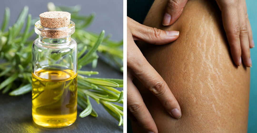 Rosemary oil