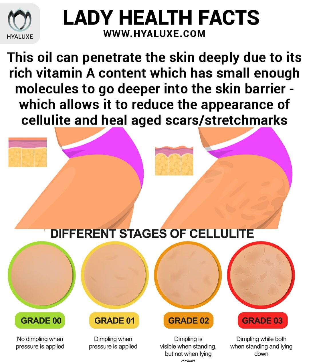 Wildcrafted Rosehip Seed Oil: The Ultimate Scar & Stretchmark Serum for Radiant Skin
