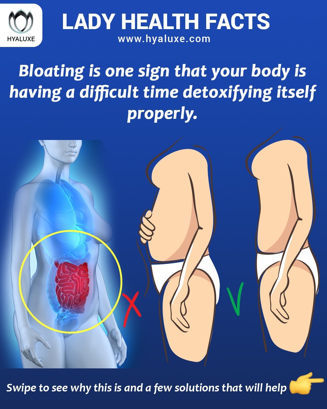 5 Signs that Your body NEEDS help : BLOAT is #1 - Hyaluxe Body