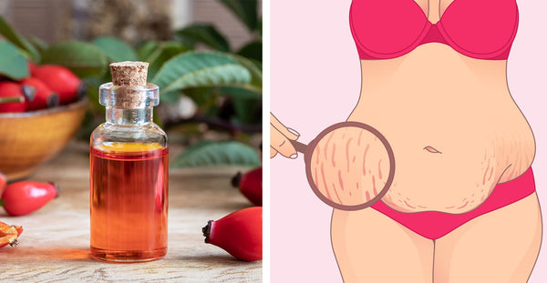 Beneficios del aceite de semilla de rosa mosqueta