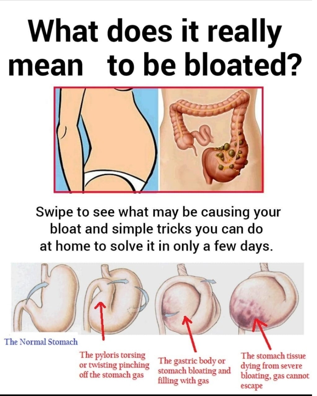 Bloat, inflammation, stubborn fat - are they related? How can you solve it? These will work... - Hyaluxe Body