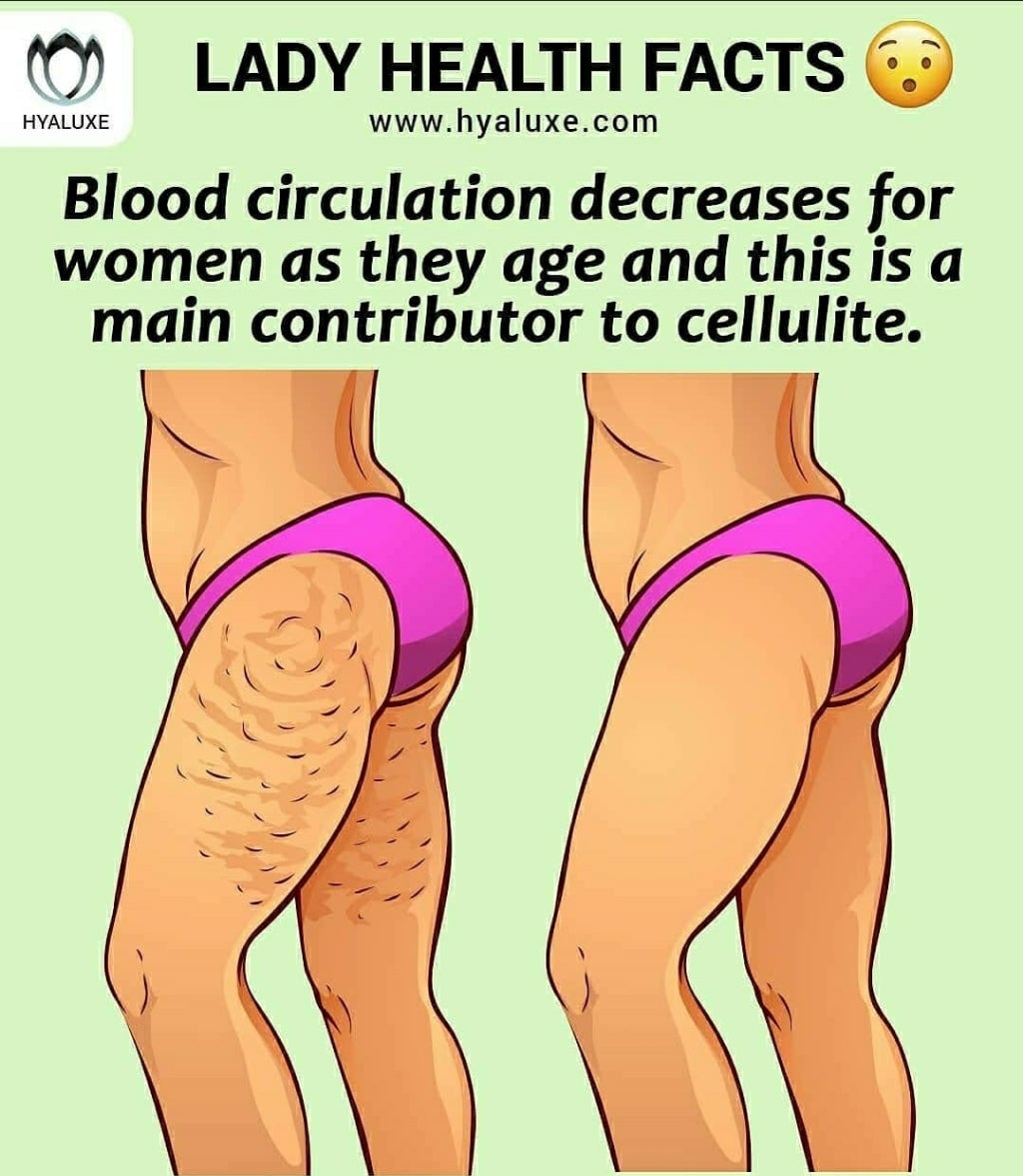 Cellulite - Why we have it and how can we get rid of it? Let's get to it ---> - Hyaluxe Body