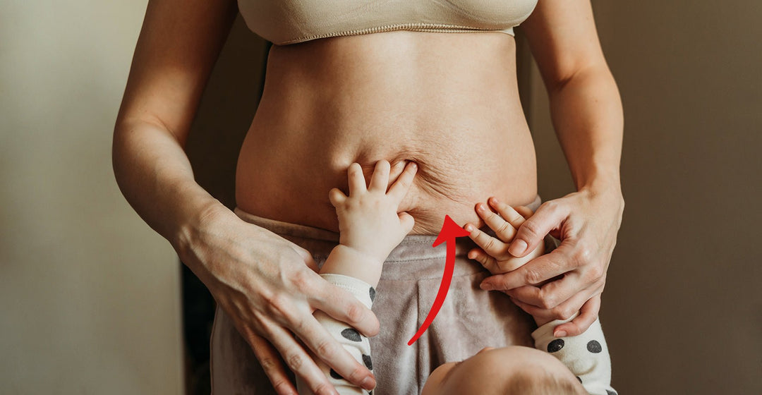 How to reduce scars and stretchmarks?