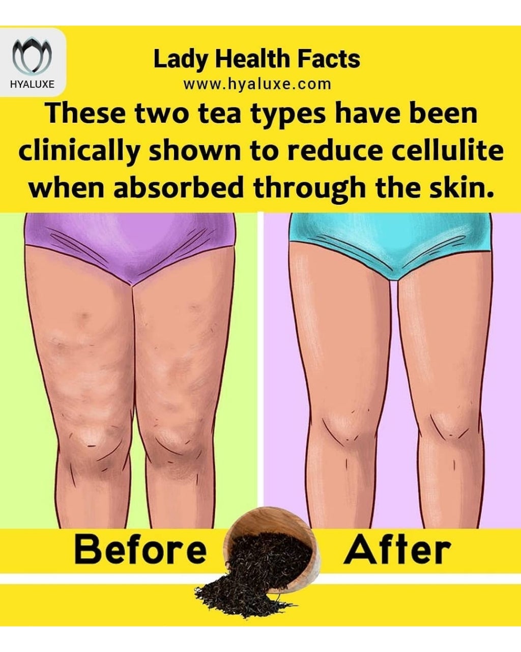 Why Kourtney Kardashian Loves These Natural Remedies for Cellulite & Skin Glow