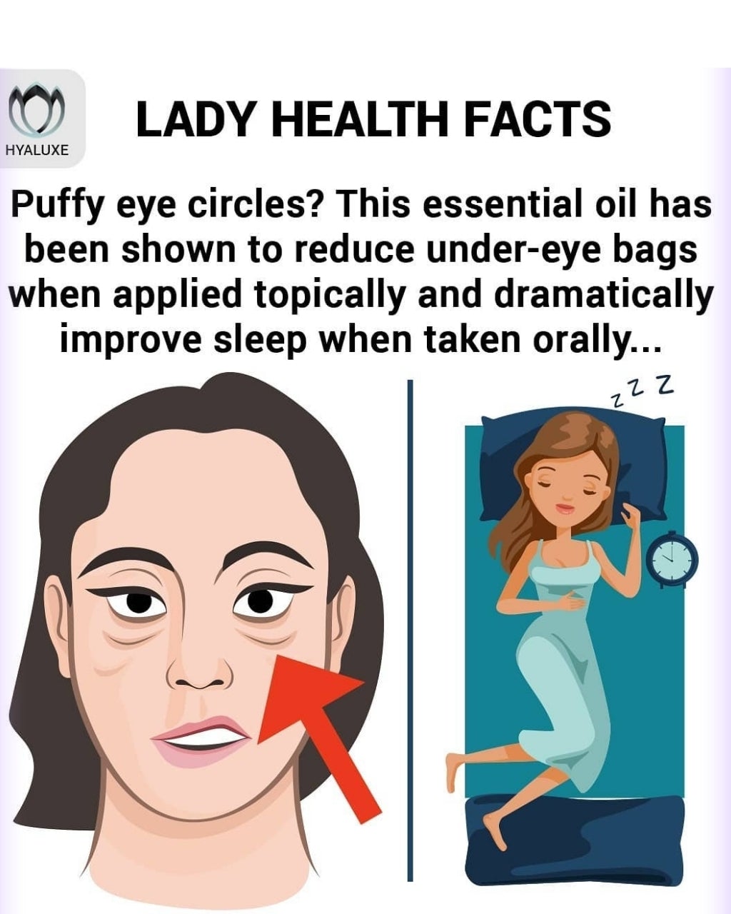 Reduce baggy circles and get better sleep? Here is how with these 3 ingredients... - Hyaluxe Body