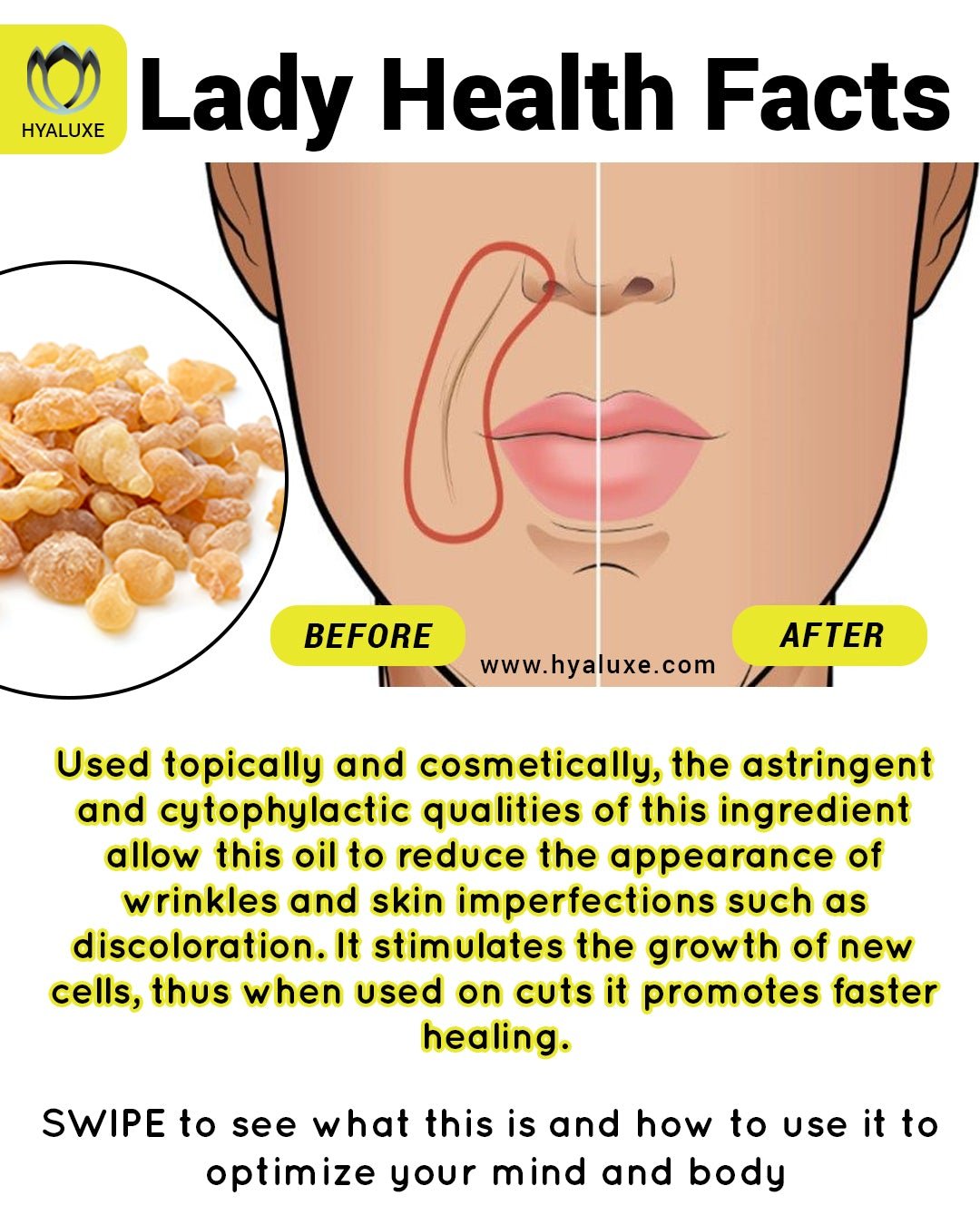 La línea fina, las arrugas profundas y la ayuda a las células anticancerígenas.